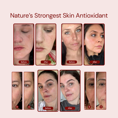 Celliant Astaxanthin Softgels — Protect Your Skin From Aging at the Cellular Level